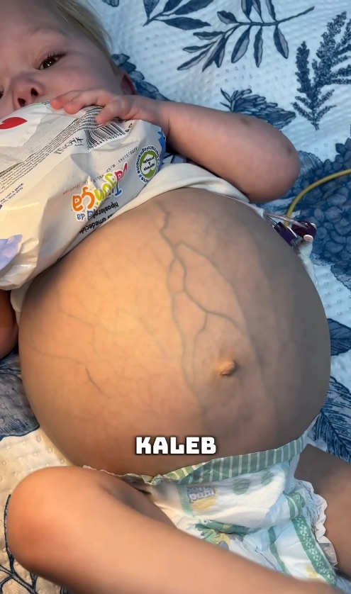 Kaleb during catheter care at an appointment